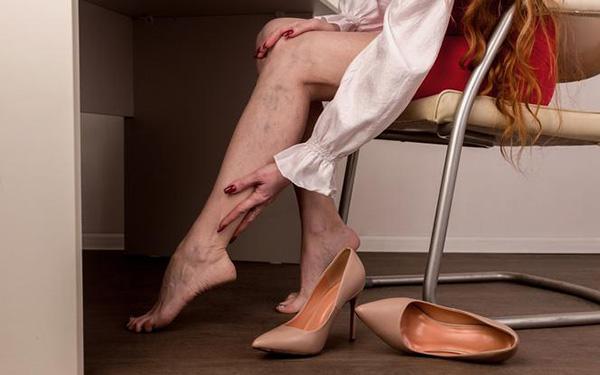 Puchną ci nogi i nie wiesz dlaczego? Te 3 problemy najczęściej odpowiadają za obrzęki nóg